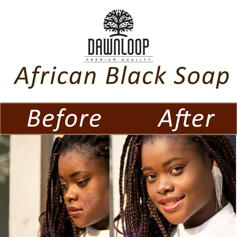 Dawnloop's Authentic Raw African Black Soap – Your Gateway to Radiant, Healthy Skin
